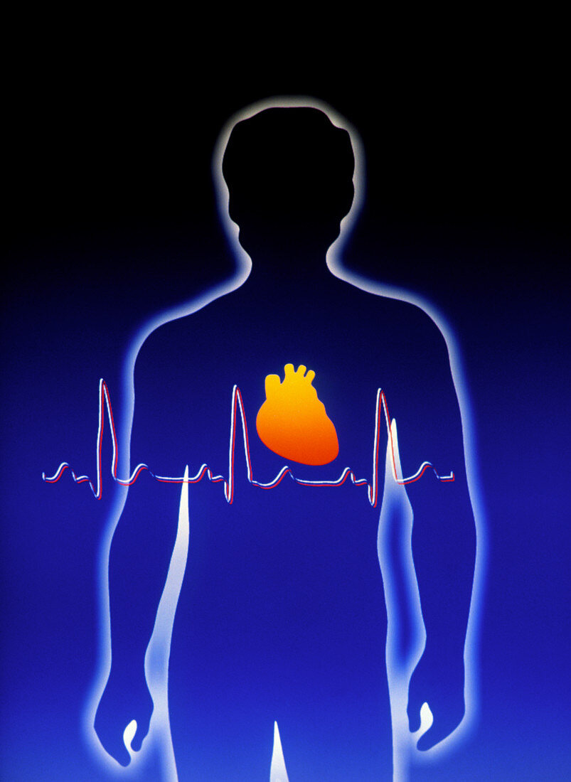 Artwork of human figure with heart and ECG trace