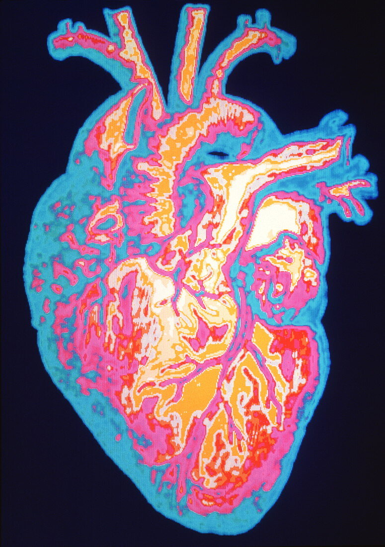 Computer artwork of a healthy human heart