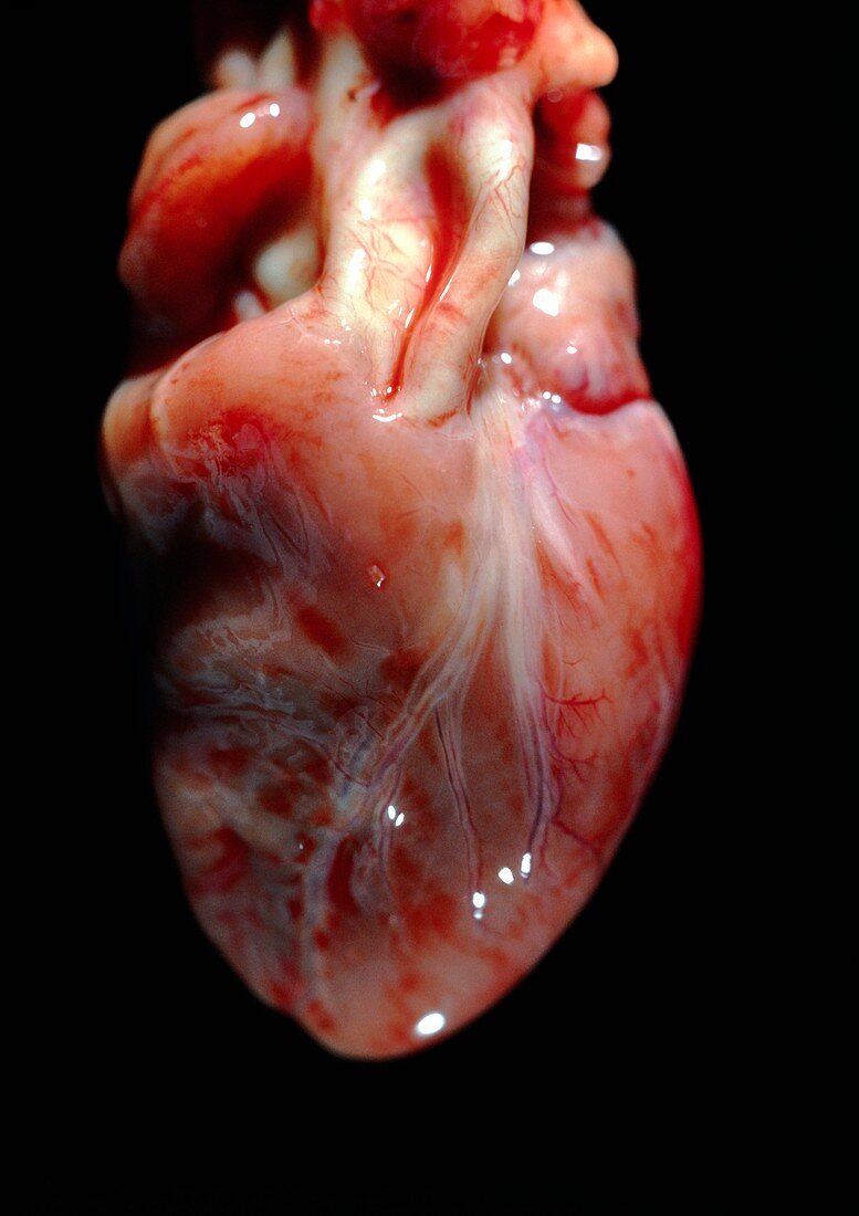 Foetal heart
