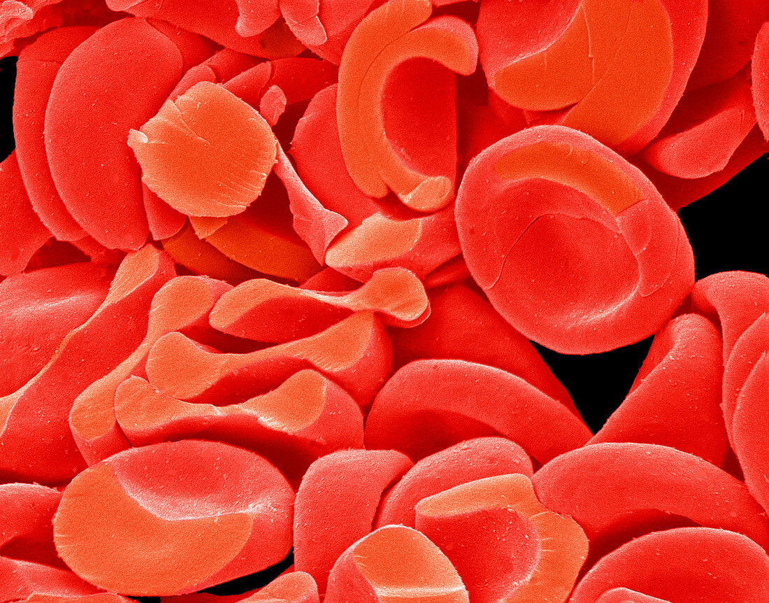 Red blood cells,SEM