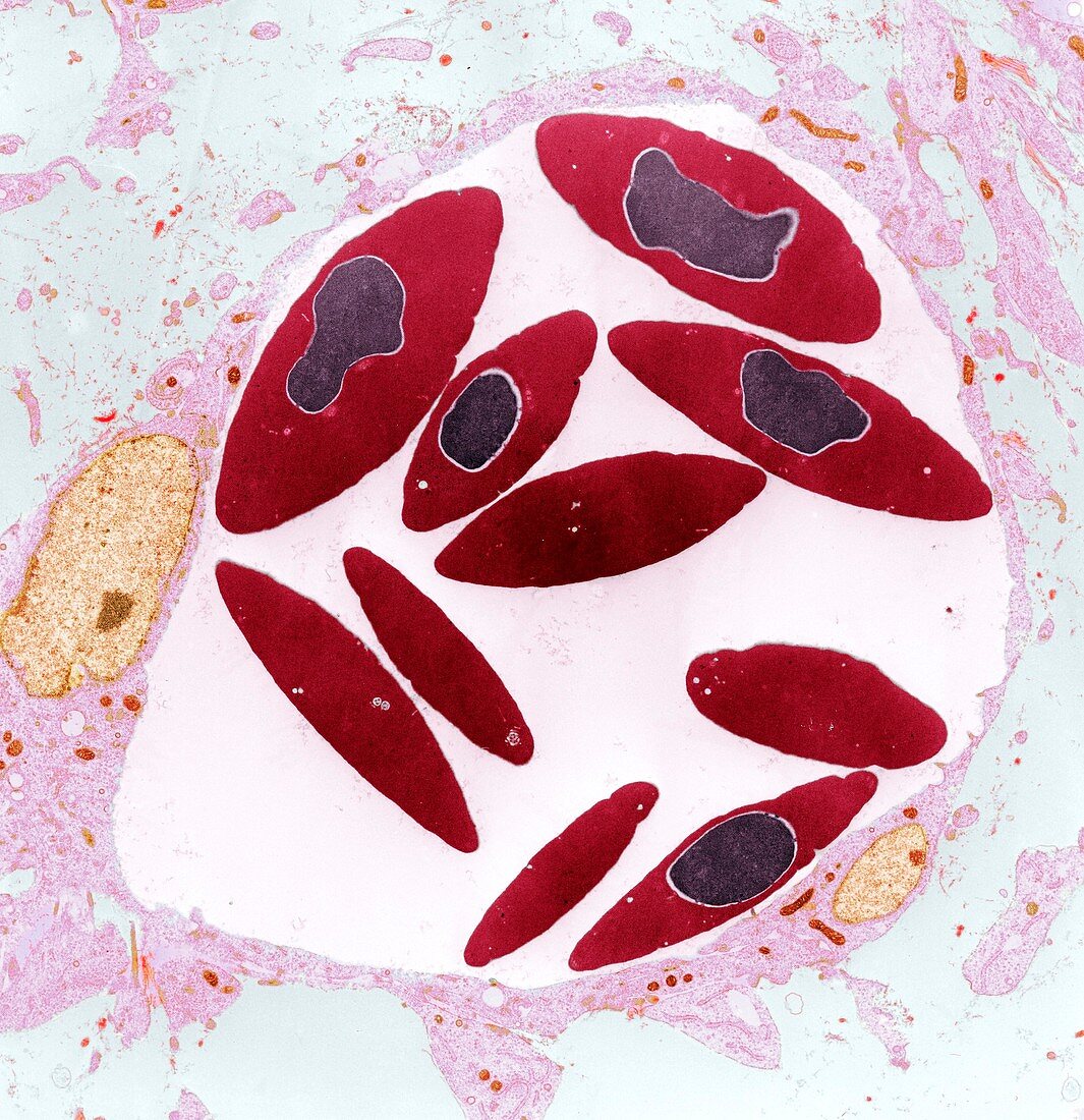 Bird's red blood cells