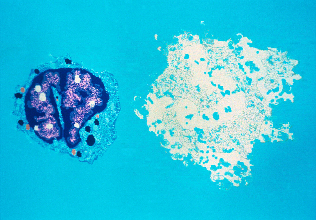 False-colour TEM of killer T-lymphocyte