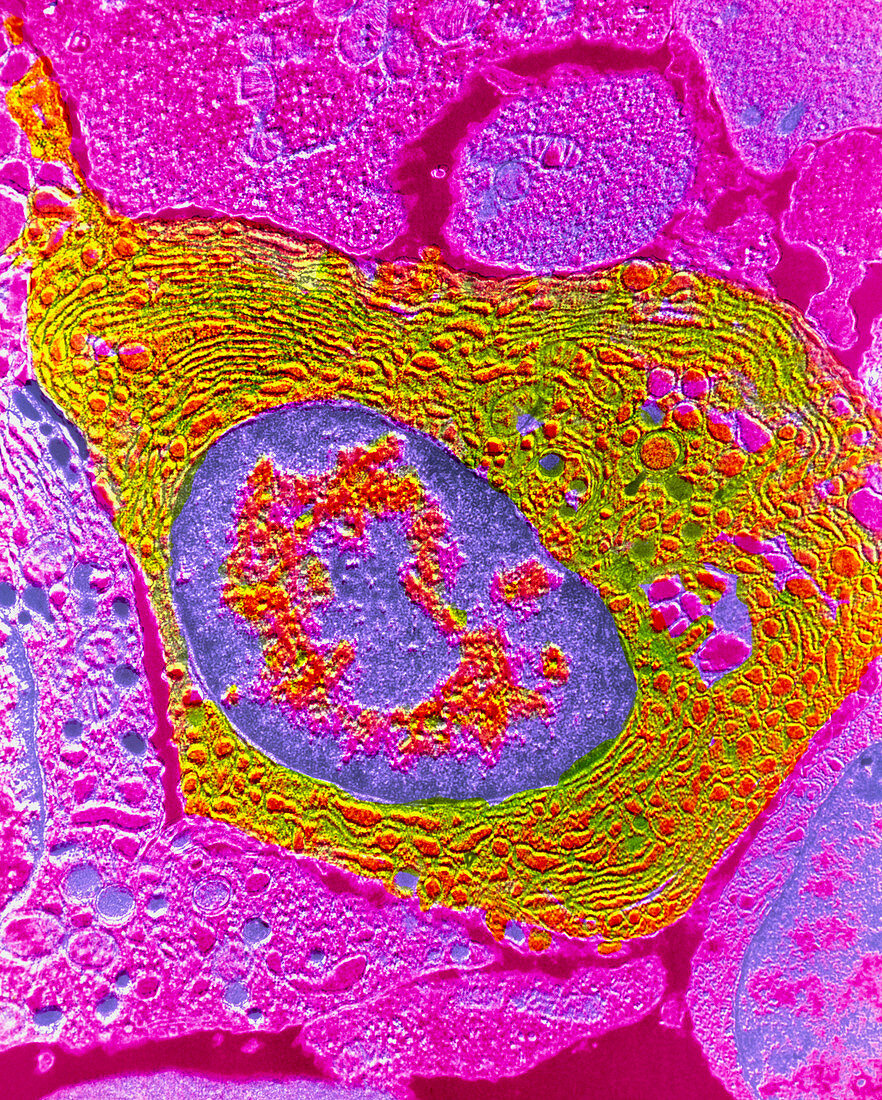 False-colour TEM of a human plasmocyte