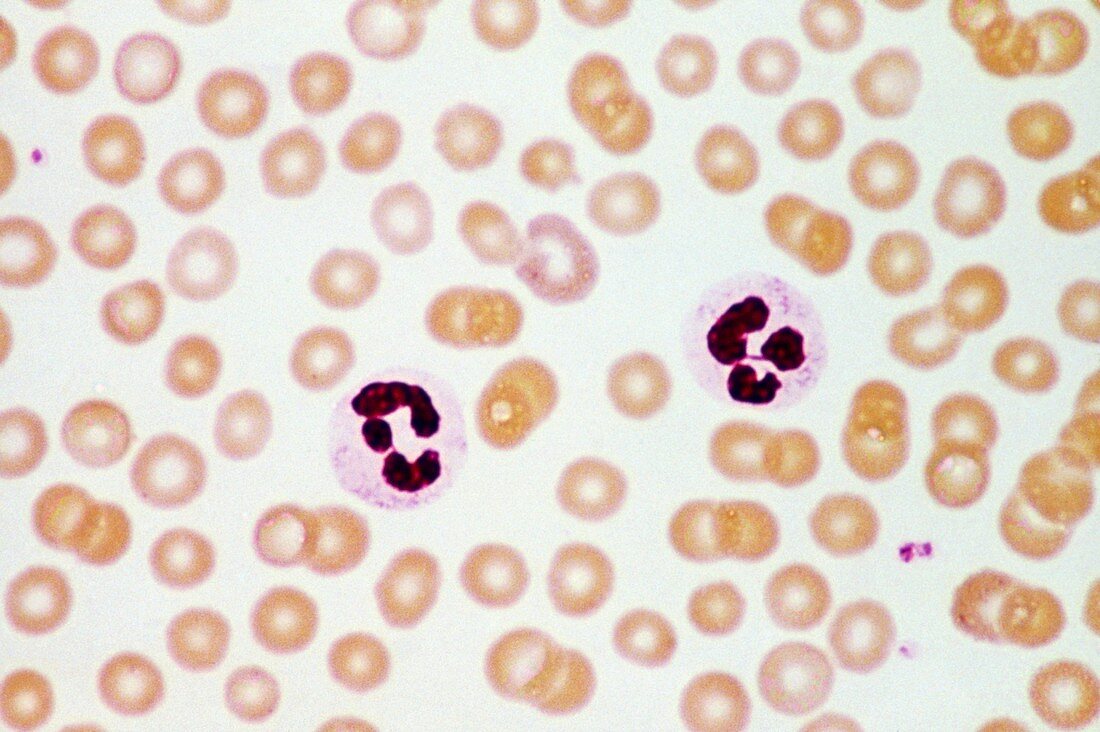LM of neutrophils