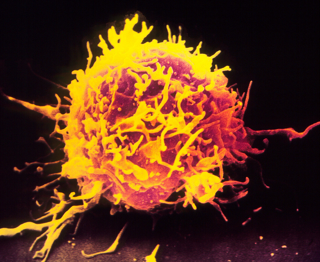 Coloured SEM of a T-lymphocyte white blood cell
