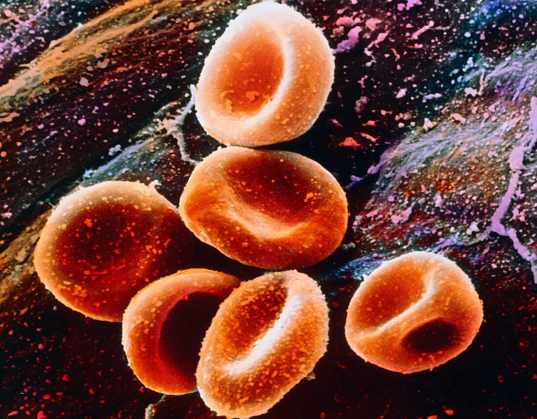 False-colour SEM of a group of red blood cells