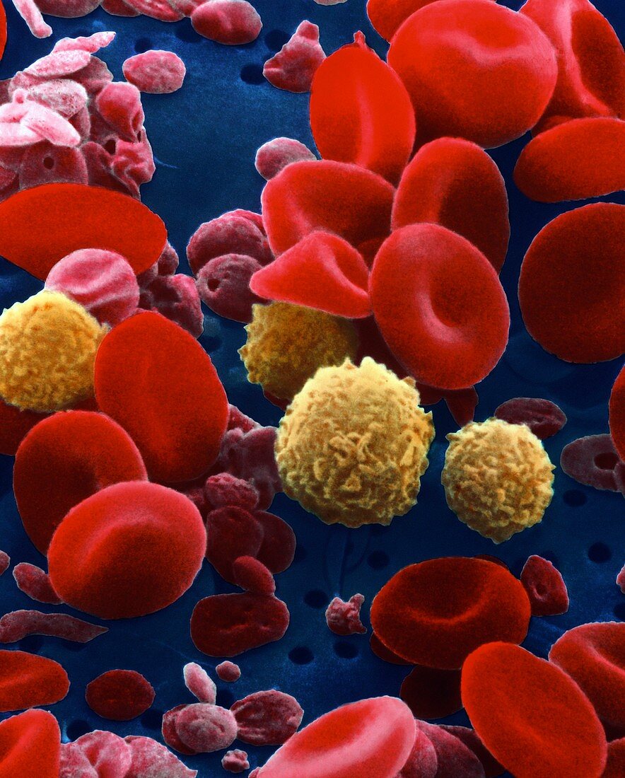 Blood cells,SEM