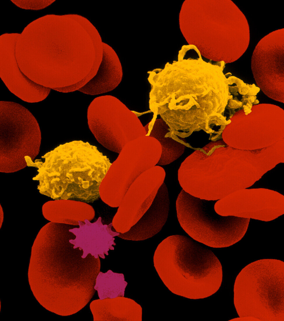 Coloured SEM of red,white & crenated blood cells