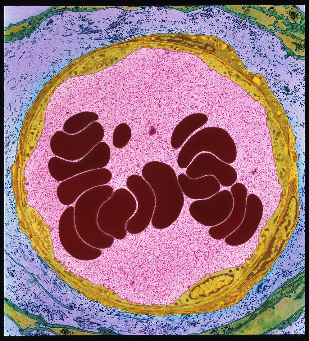 Coloured TEM of red blood cells in an arteriole