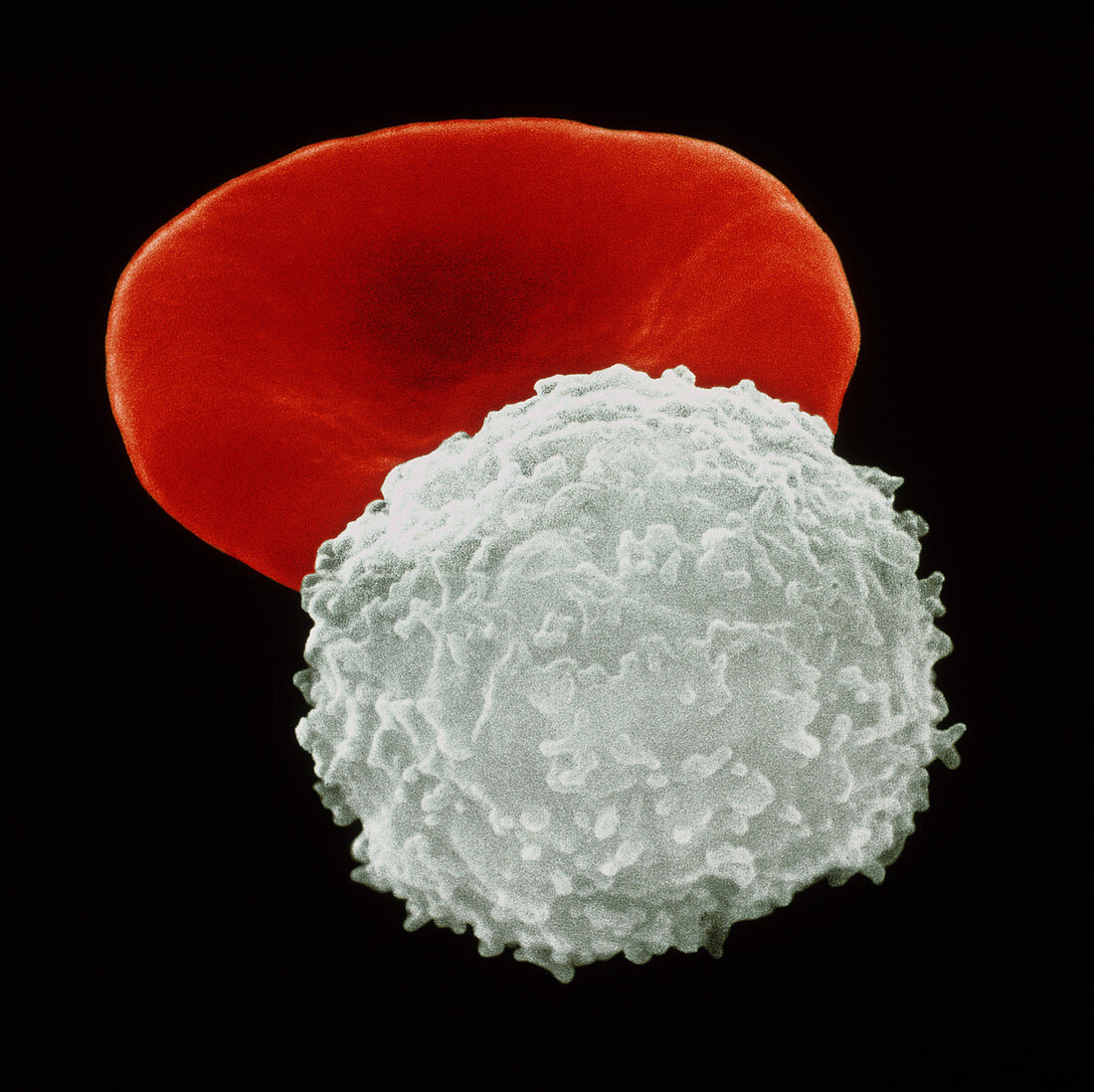 Coloured SEM of a red and white blood cel