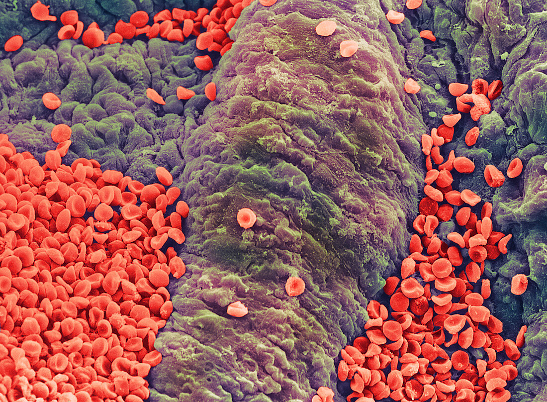 Coloured SEM of red blood cells on vessel wall