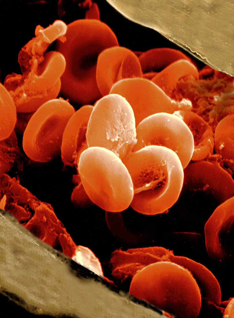 Red blood cells,SEM