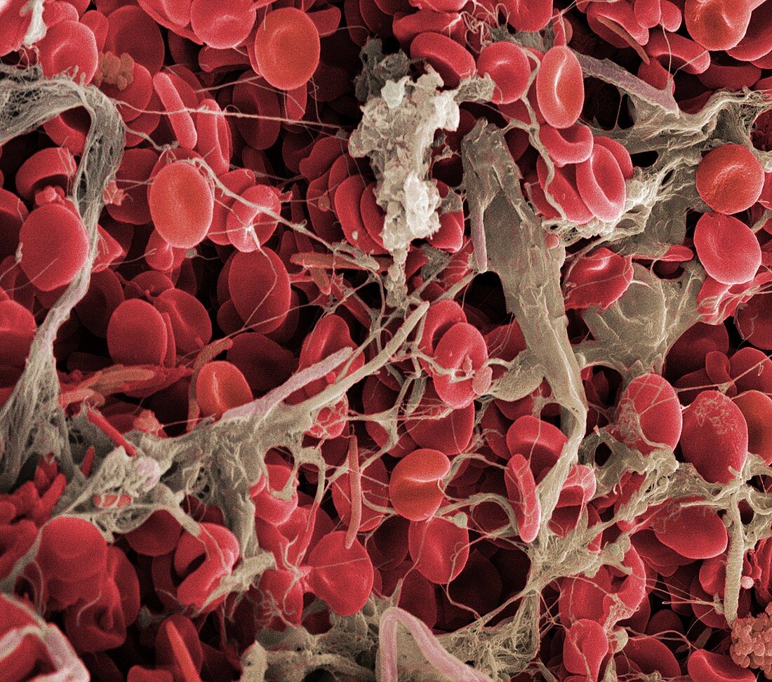 Blood clot,SEM