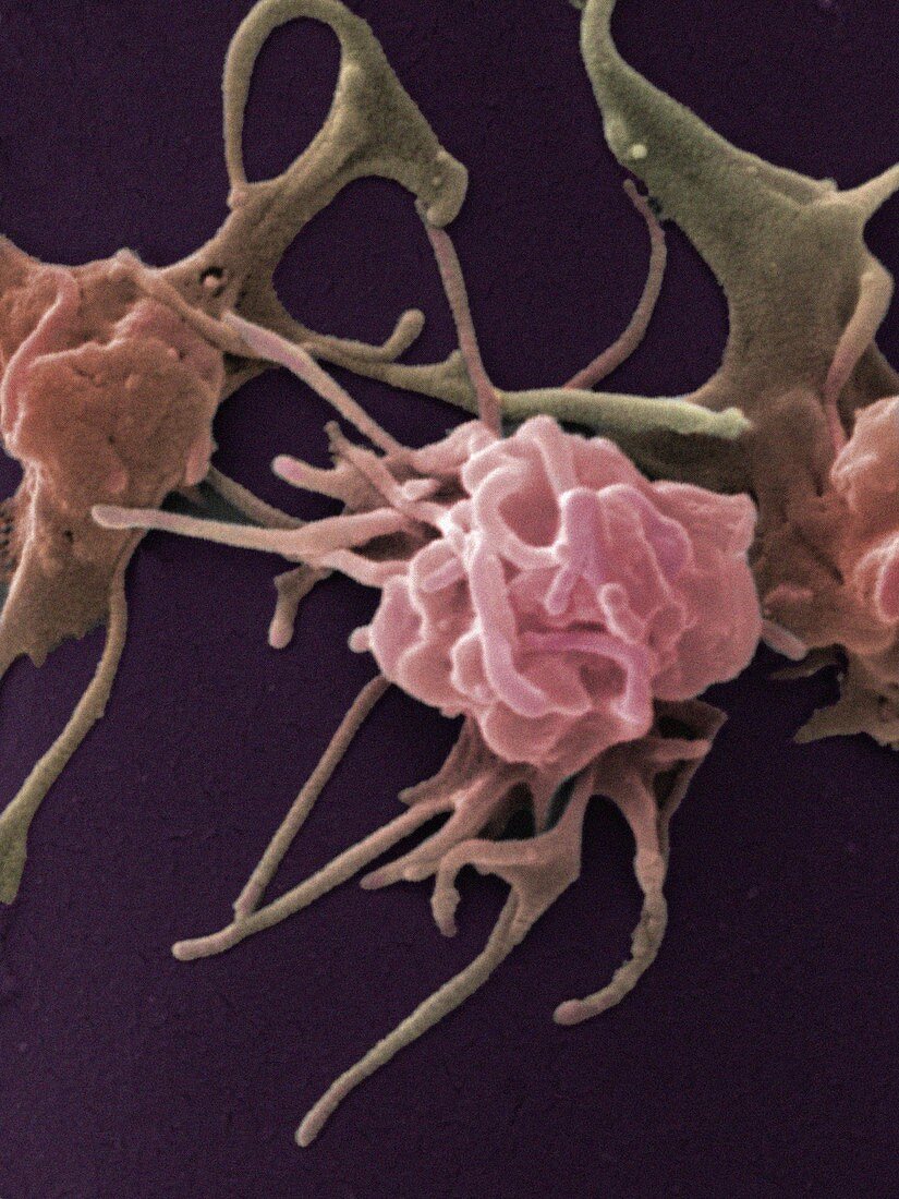 Activated platelets,SEM