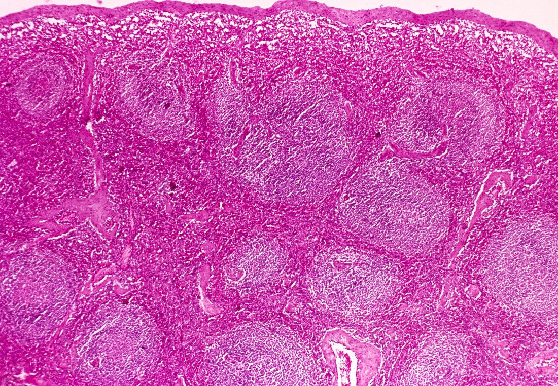 Light micrograph of a cross section through spleen