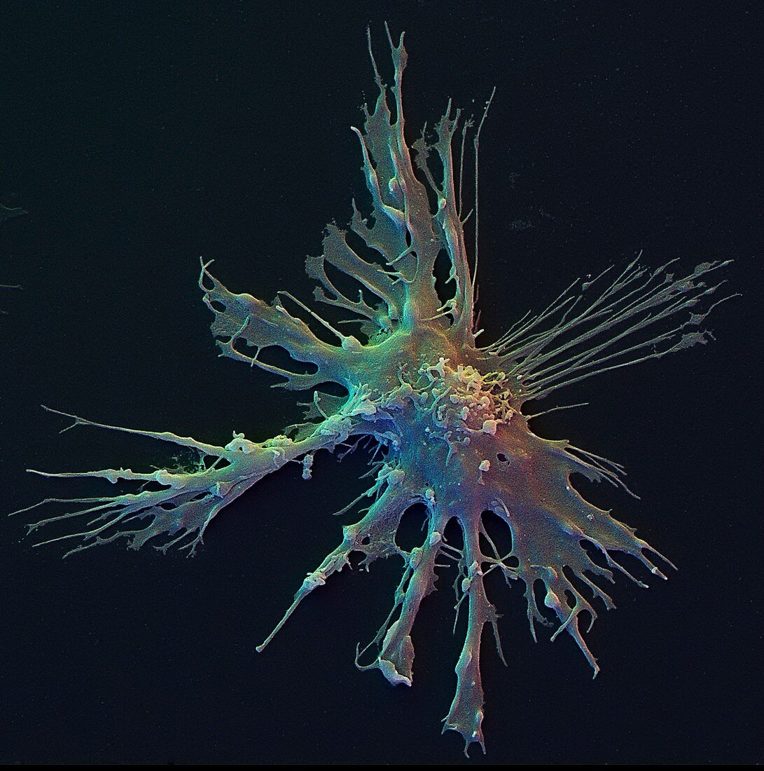 Colour SEM of dendritic immune cell