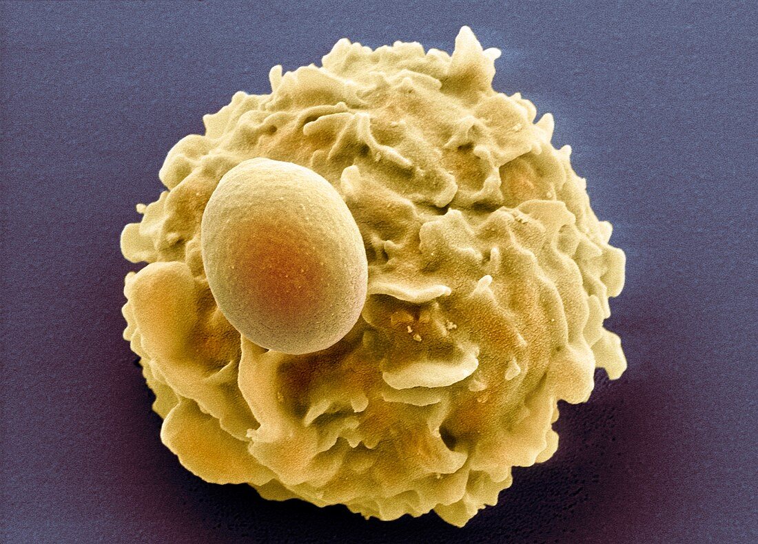 Phagocytosis of a yeast spore,SEM