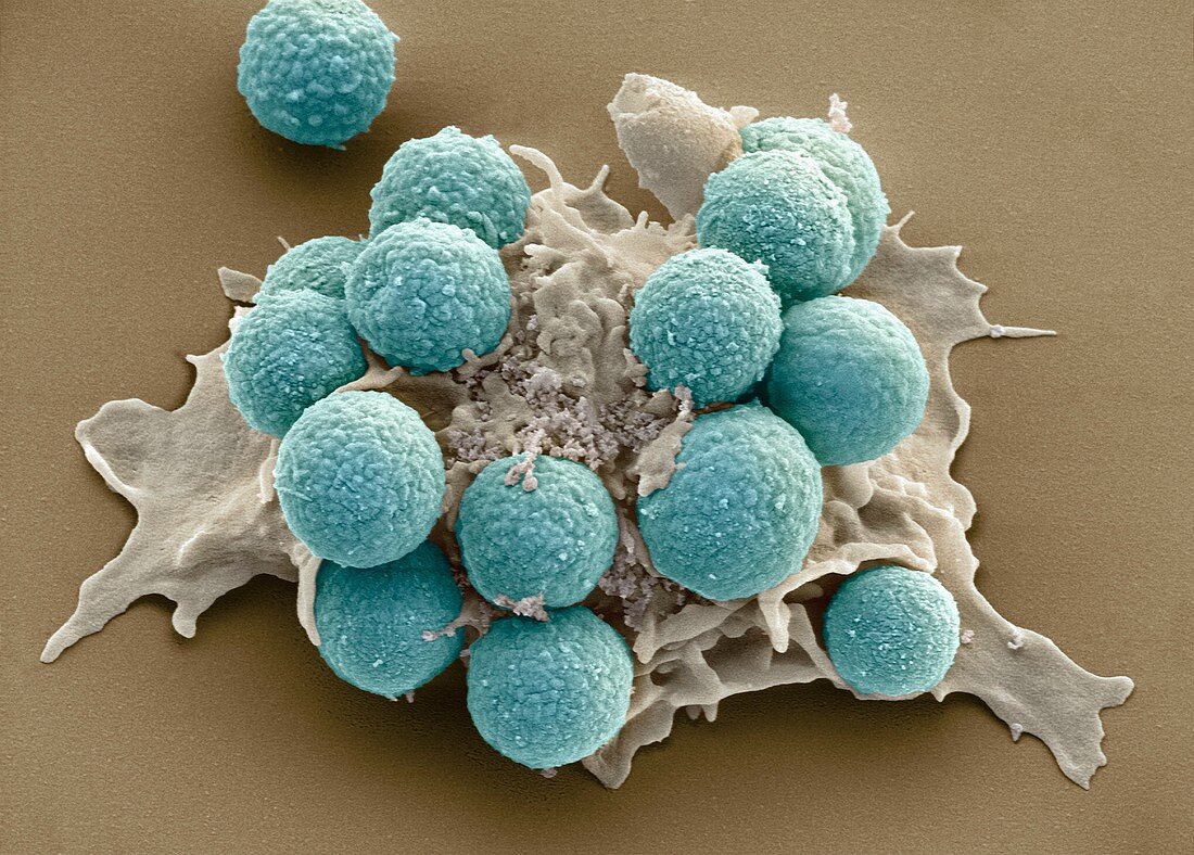Phagocytosis of fungus spores,SEM