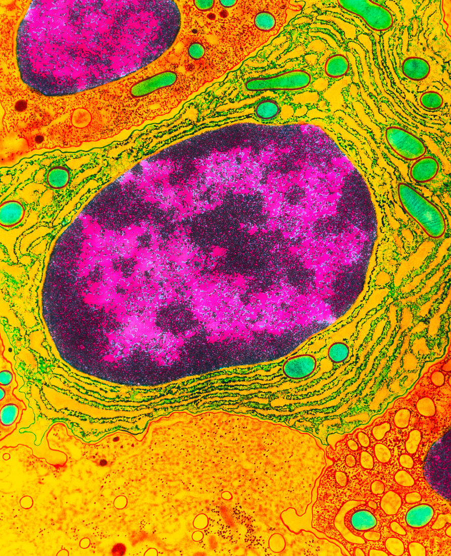Colour TEM of a plasma cell