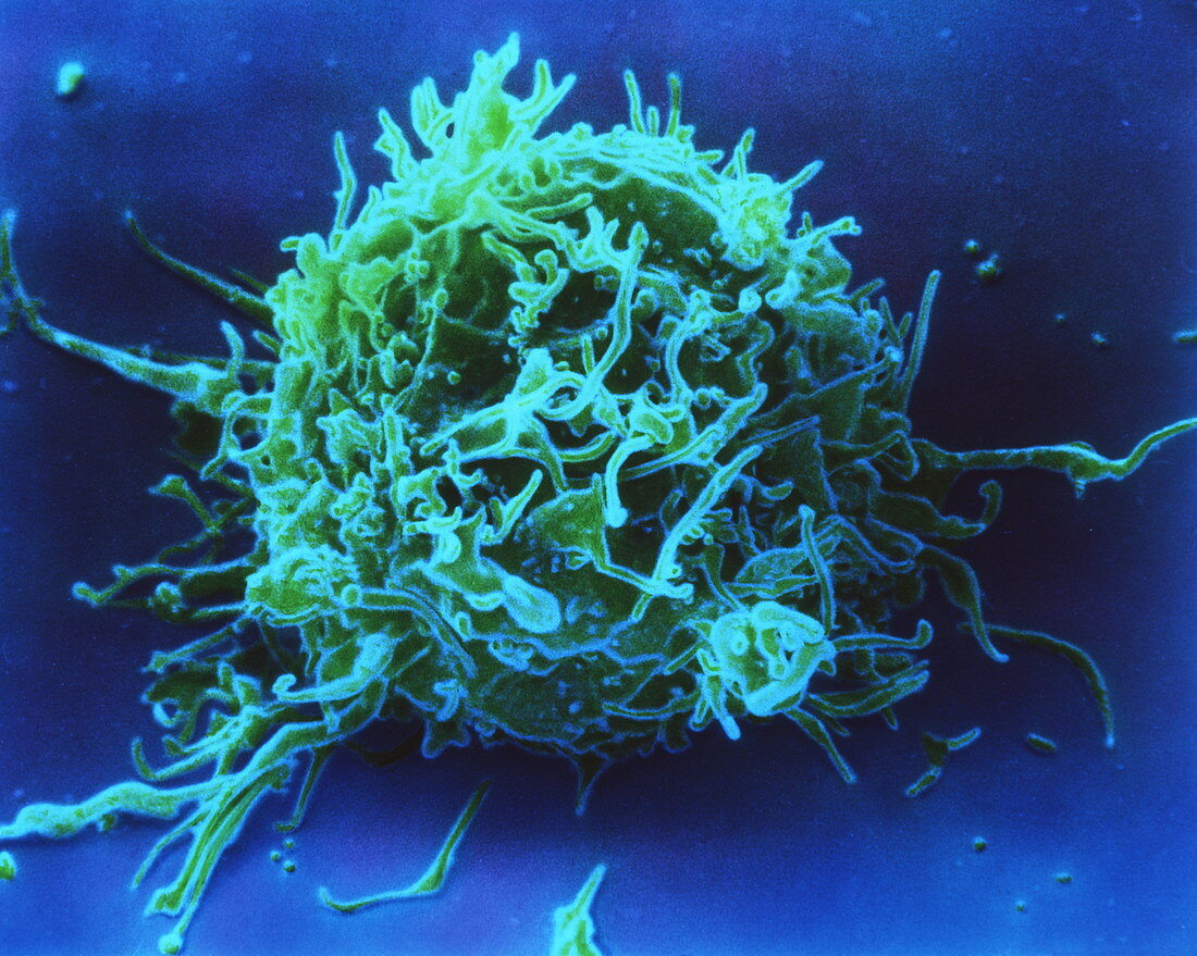 Coloured SEM of a T-lymphocyte white blood cell