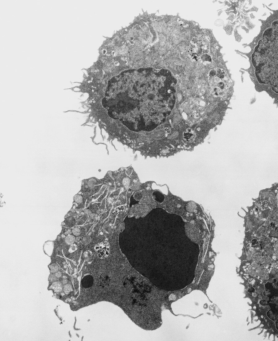 TEM of a myeloid white blood cell during apoptosis
