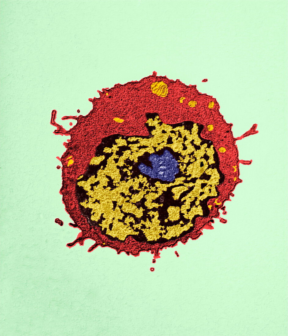 T-lymphocyte,TEM