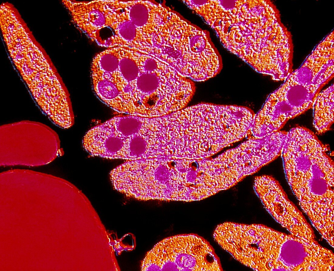 F/col TEM Unactivated blood platelets