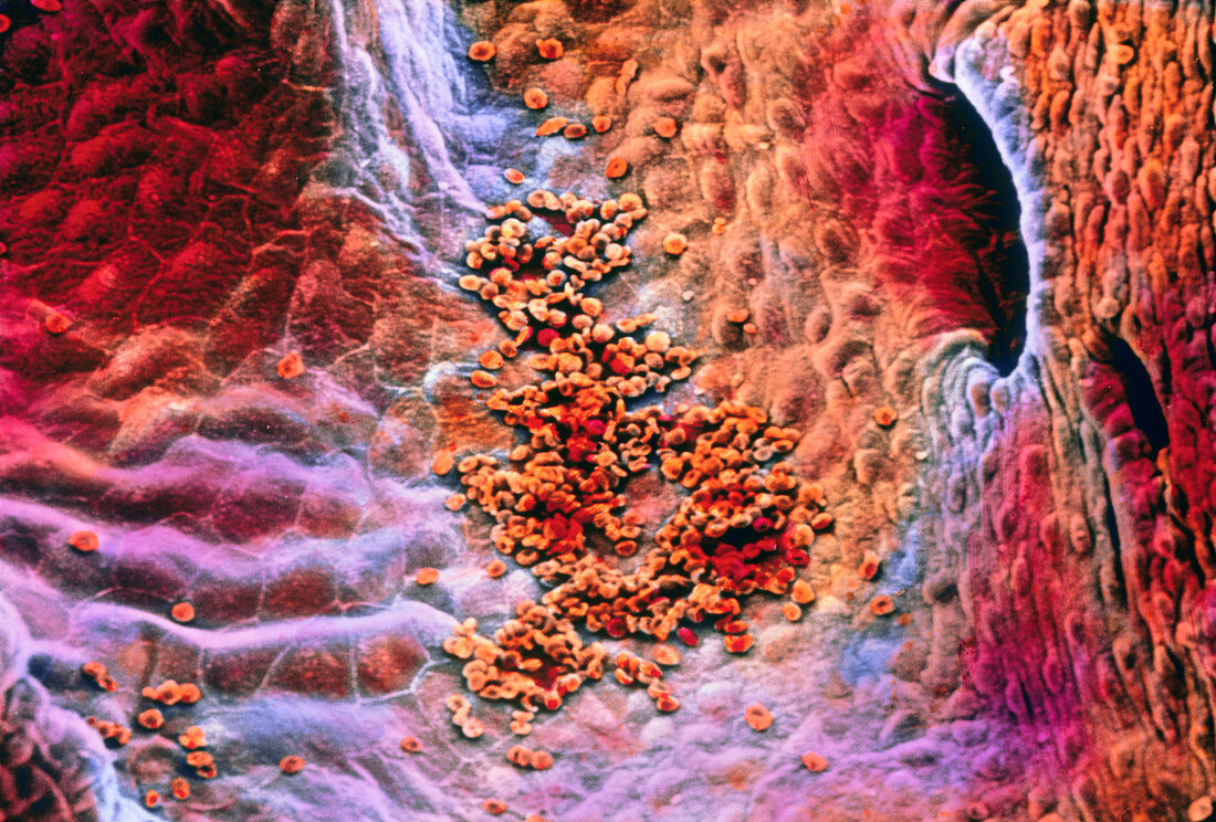 False-colour SEM early clot formation in