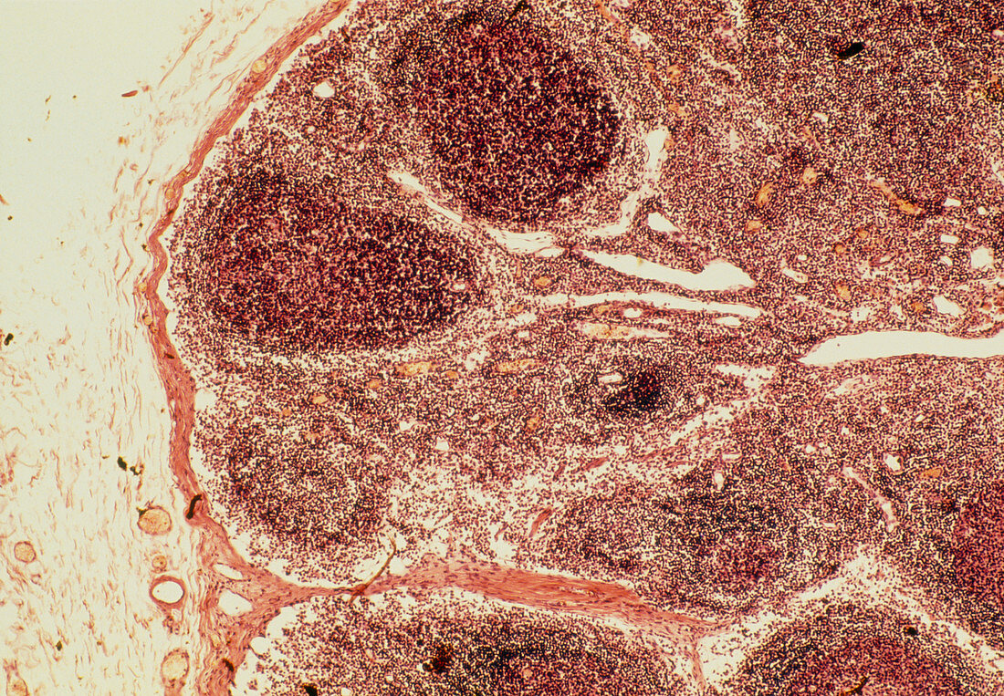 Light micrograph of a healthy human lymph node