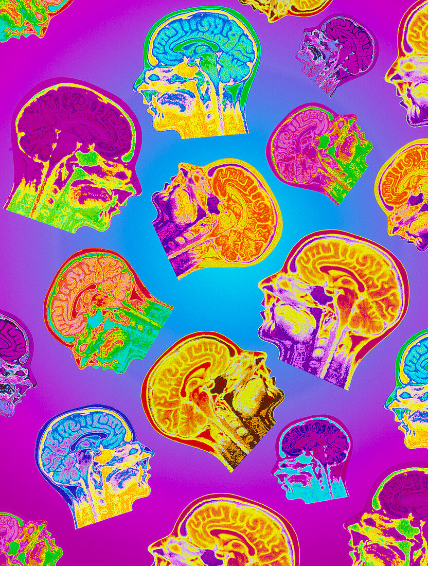 Abstract coloured MRI scans of the human brain