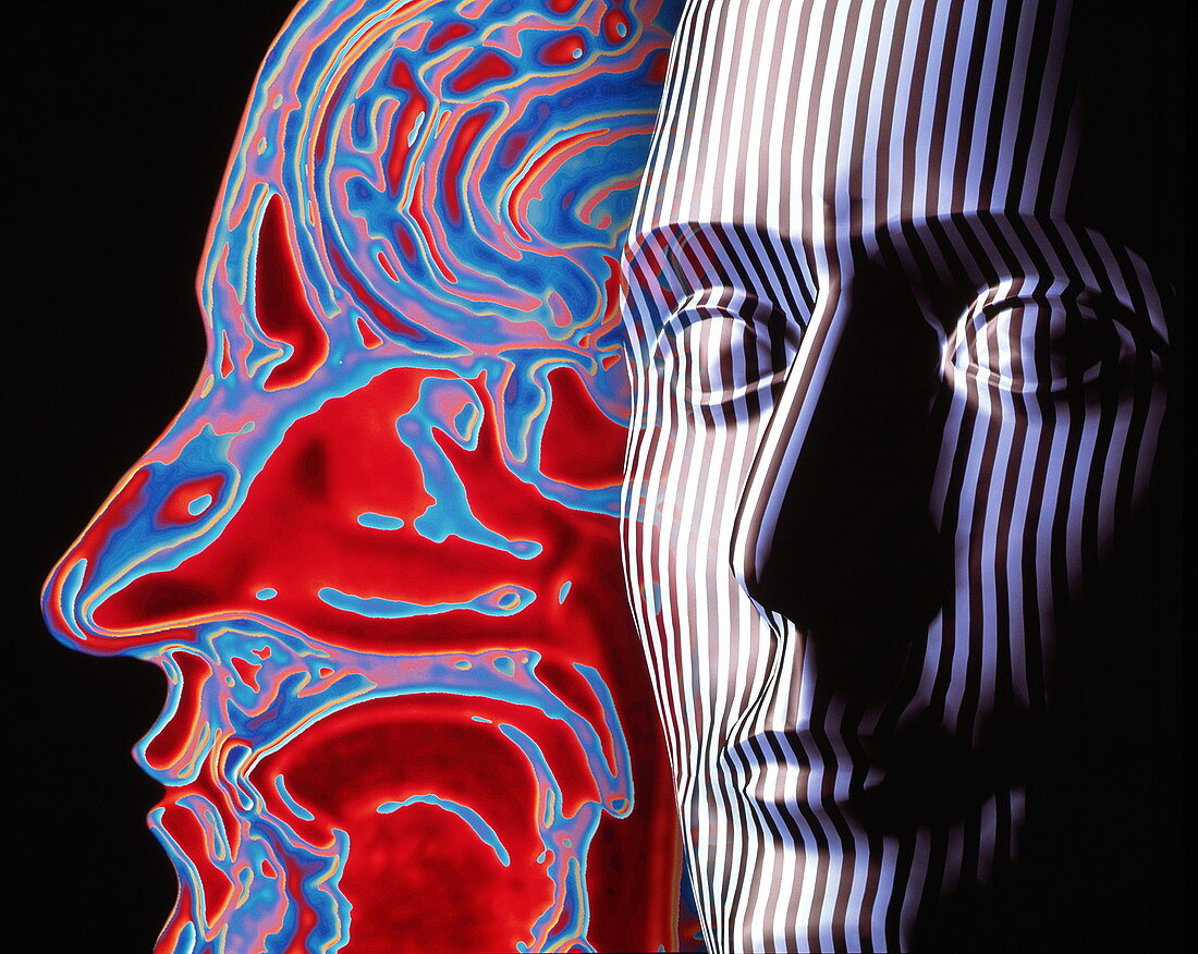 Artwork of a face and an MRI scan of a head