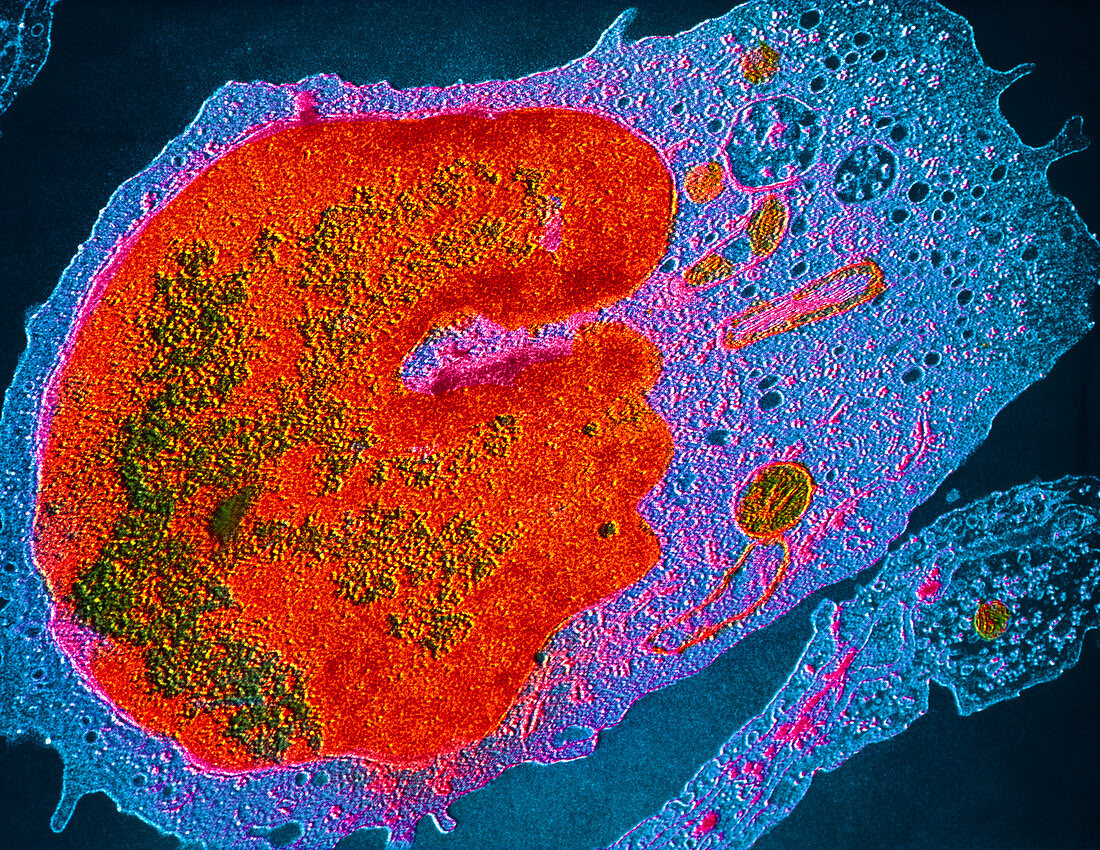 False-colour TEM of human monocyte