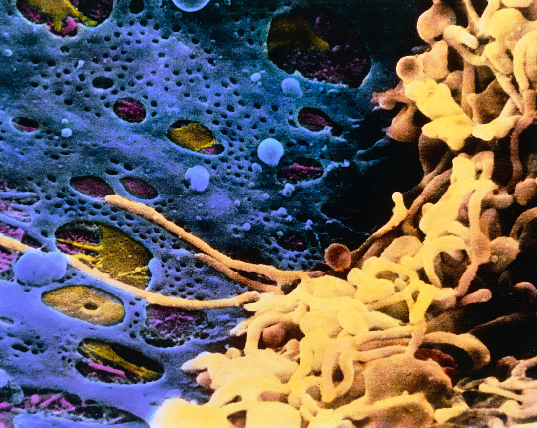 False-colour SEM of Kupffer cells in the liver