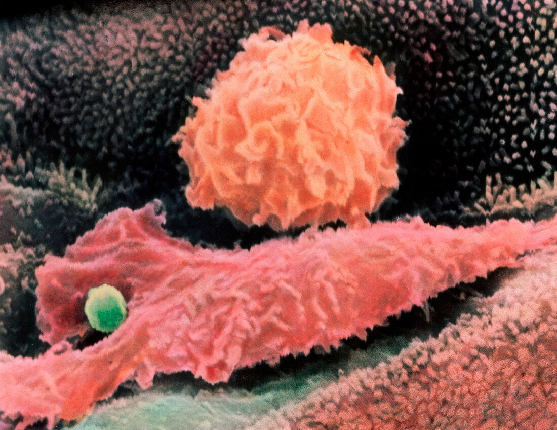 Macrophages in lung