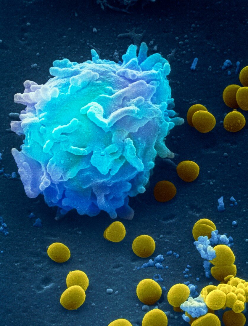 SEM of leucocyte with Staphylococcus bacteria