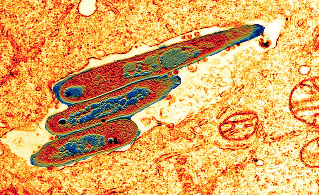 Macrophage cell engulfing bacteria,TEM