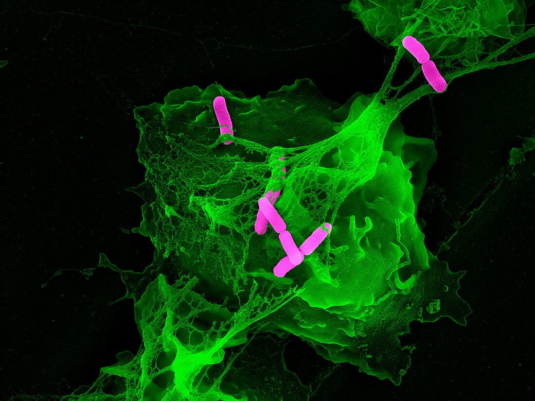 Neutrophil cell trapping bacteria,SEM