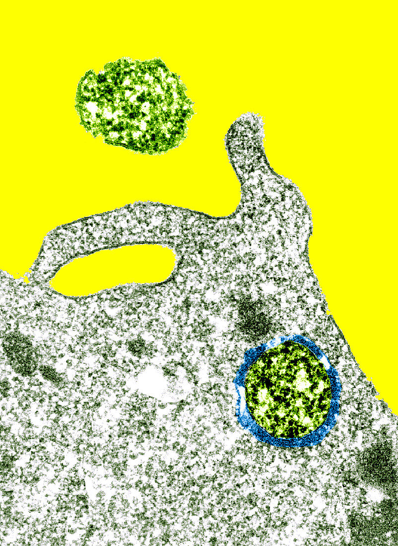 Macrophage attacking Mycoplasma bacteria