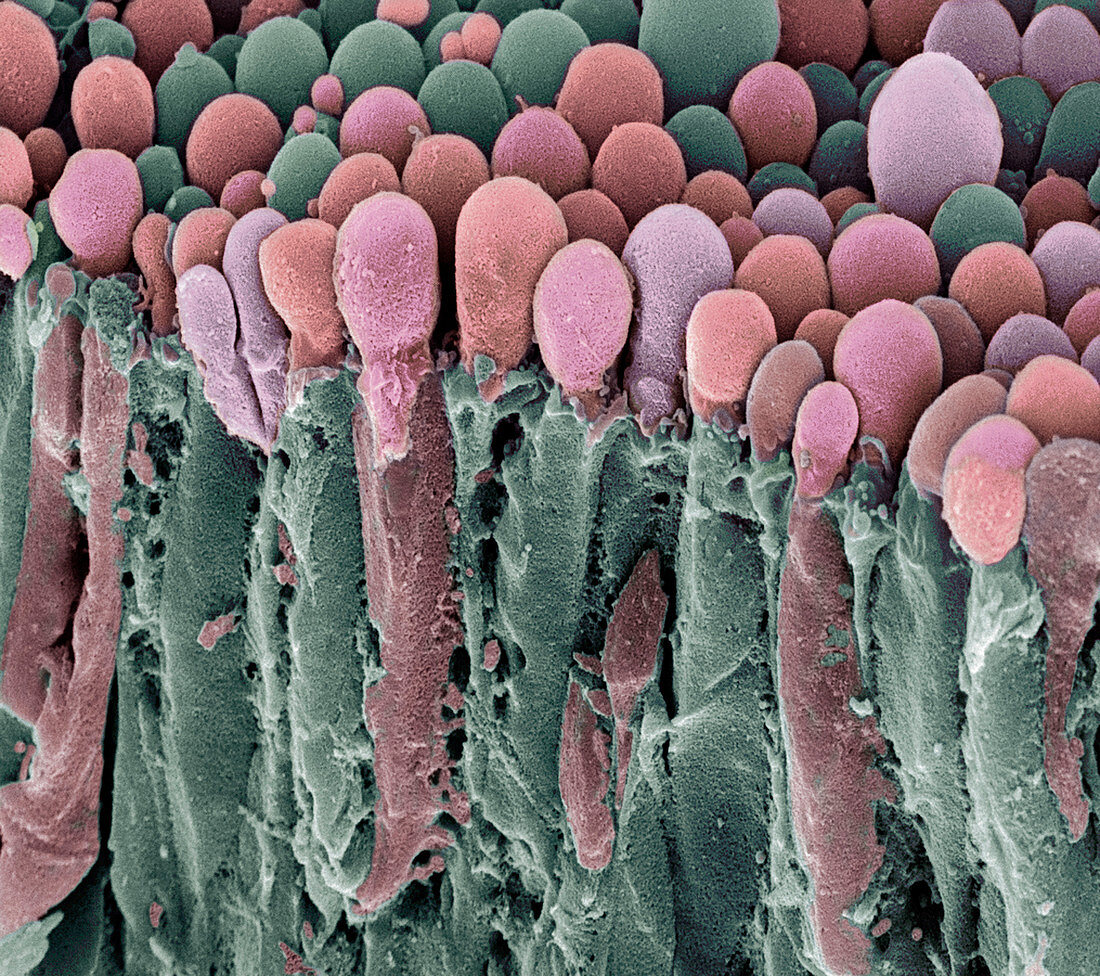 Choroid plexus secretory cells,SEM