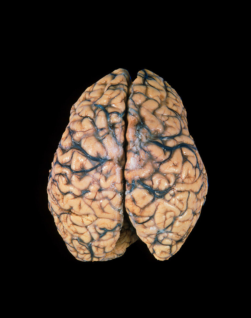 Top view of a healthy human brain