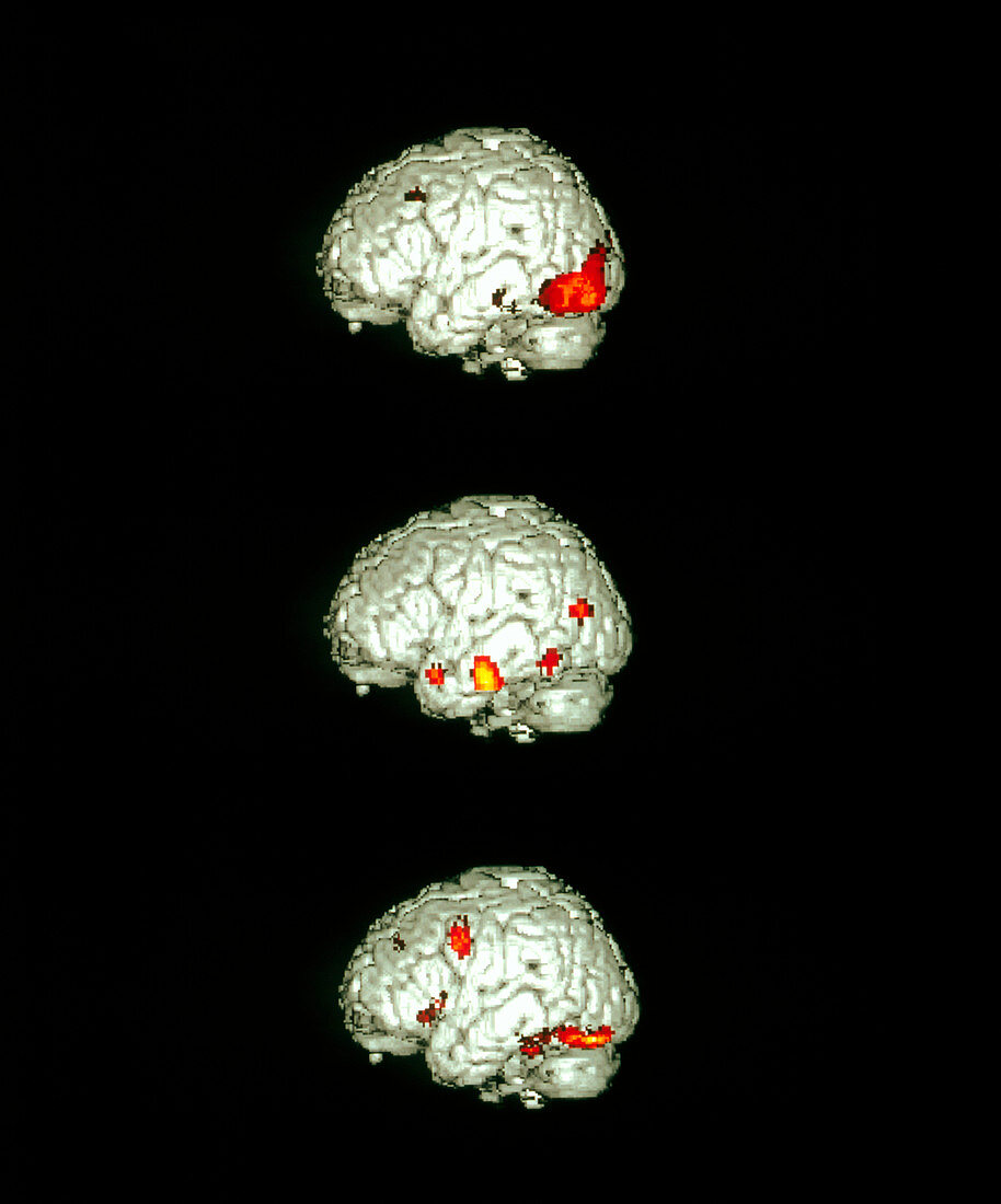 Image-processing brain activity