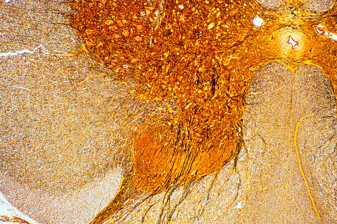 LM of a section through the human spinal cord