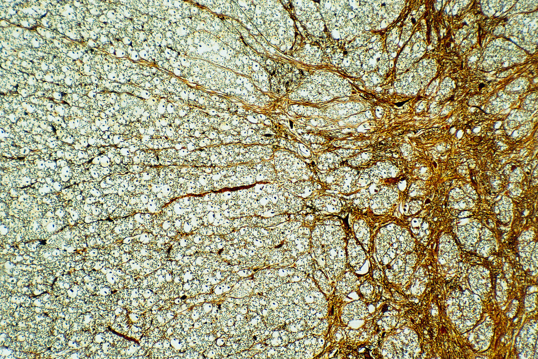Light micrograph of normal human spinal cord