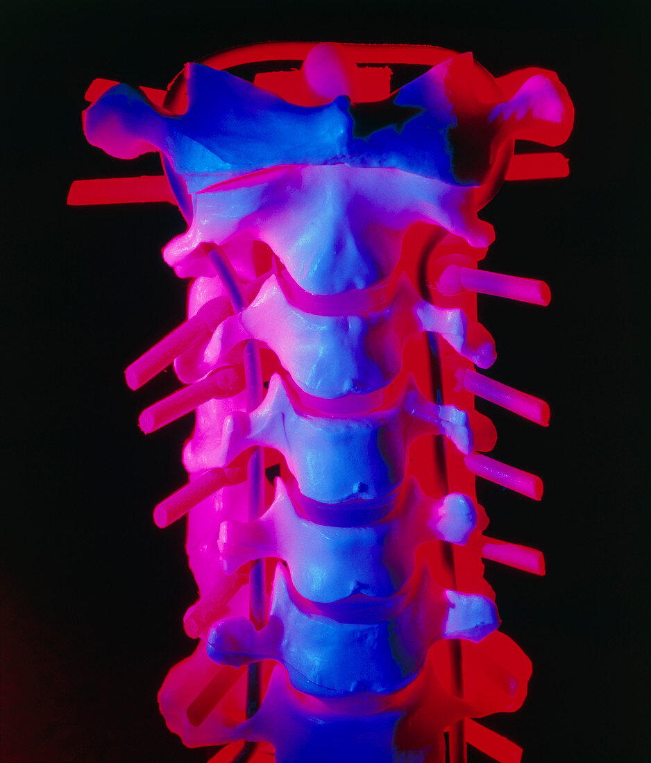 Model of the cervical spine