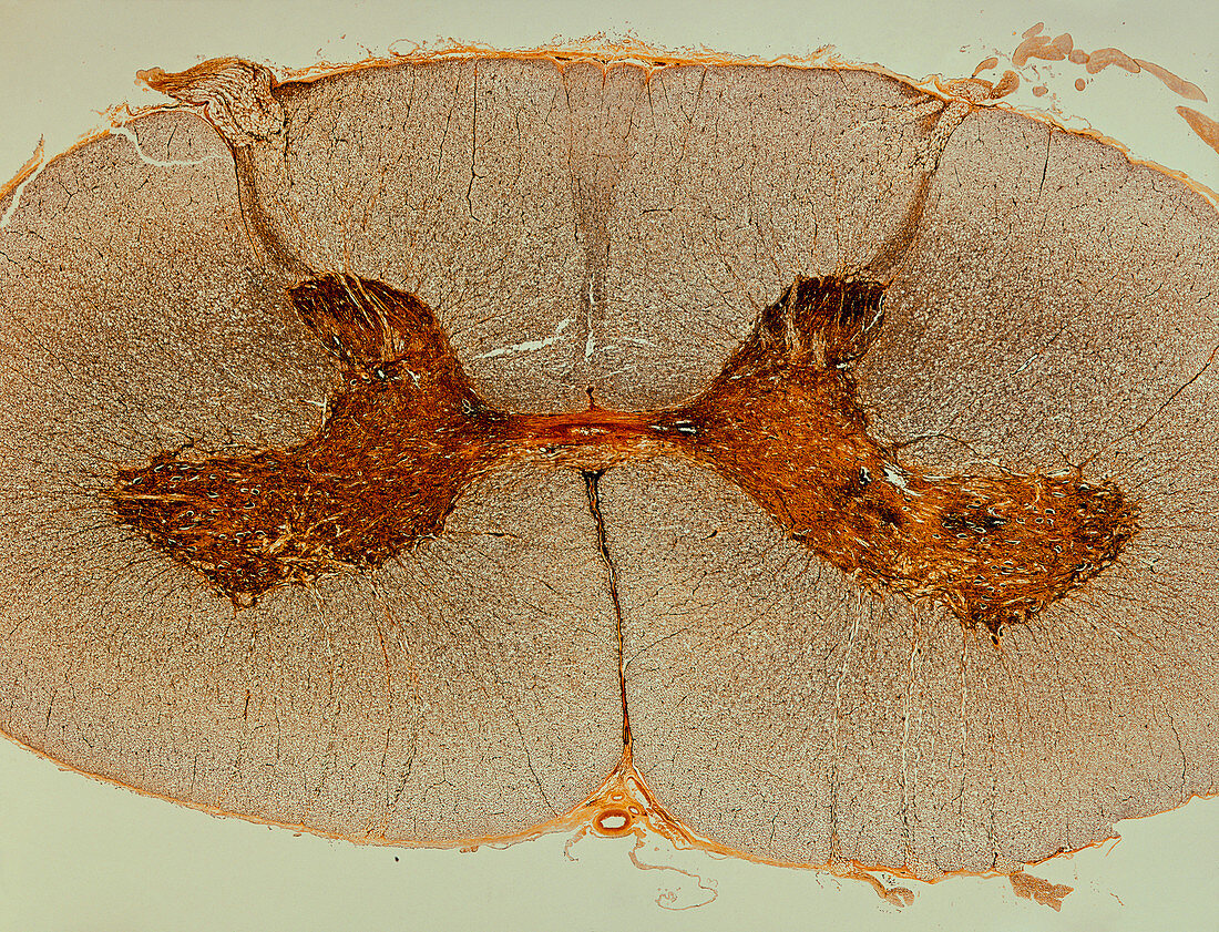 LM of a cross section of a spinal cord
