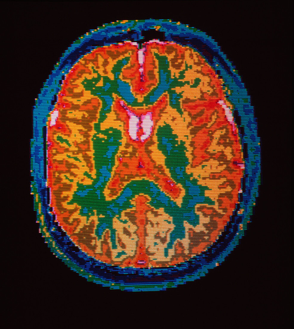 False-colour NMR scan of brain,transverse section