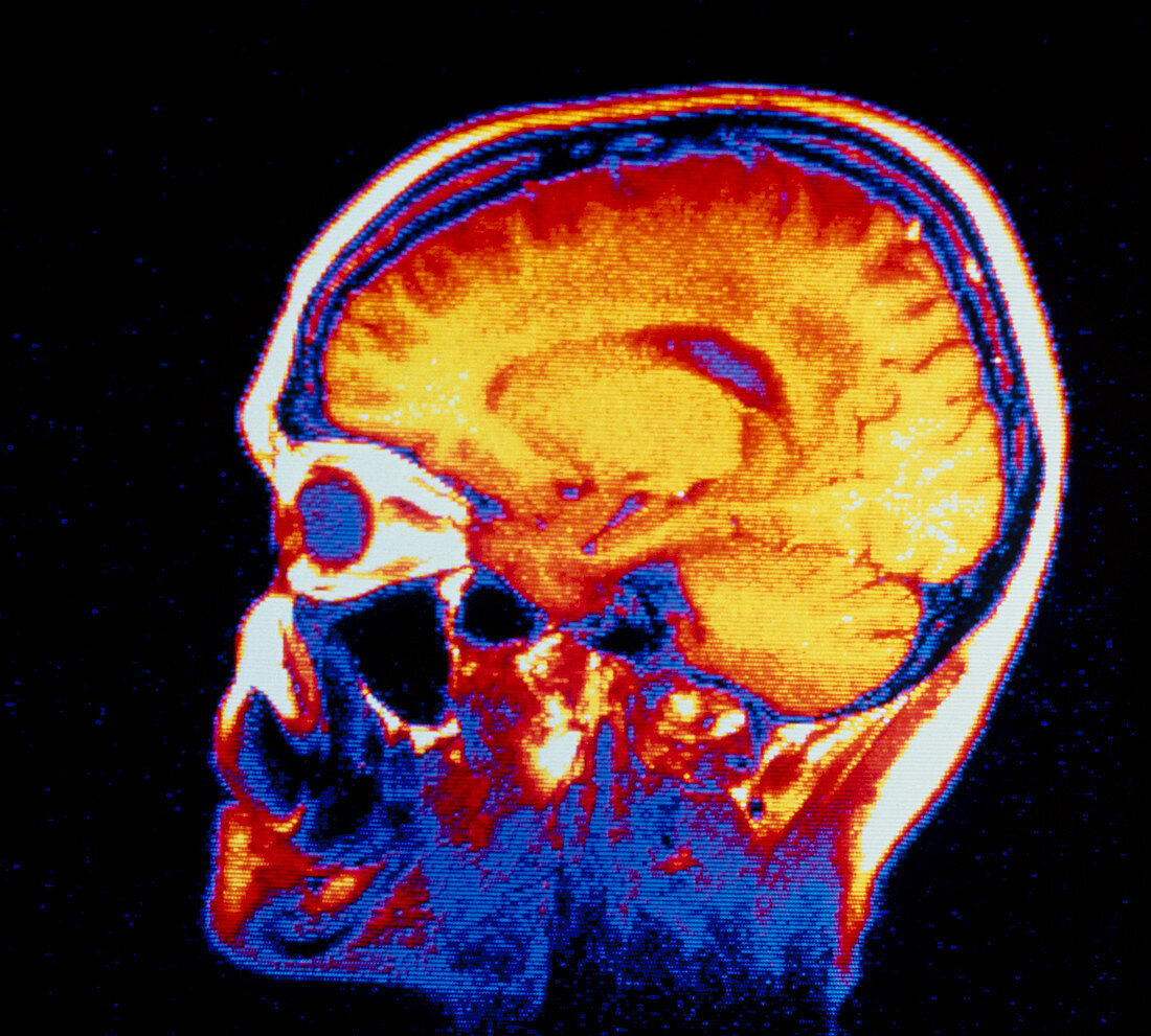 False-colour NMR scan of the head,sagittal slice