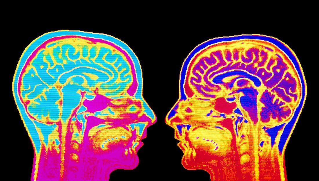 F/col MRI mid-sagittsal scan of normal brain