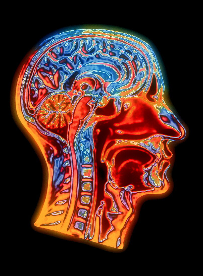 Coloured MRI scan of the human head (side view)