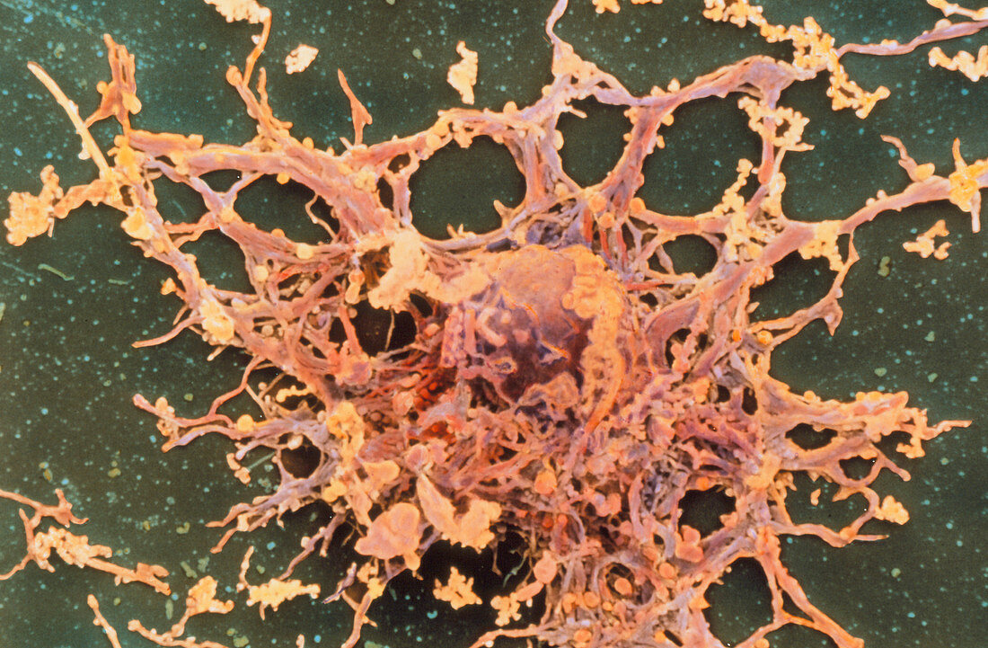Coloured SEM of an oligodendrocyte nerve cell